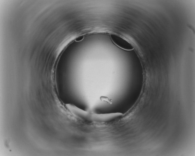 X0000099381190200805151611