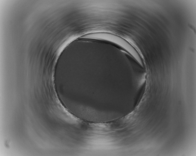 X0000099381197200805151611