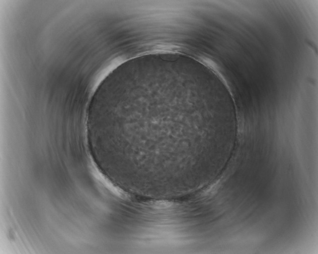 X0000099381235200805151611