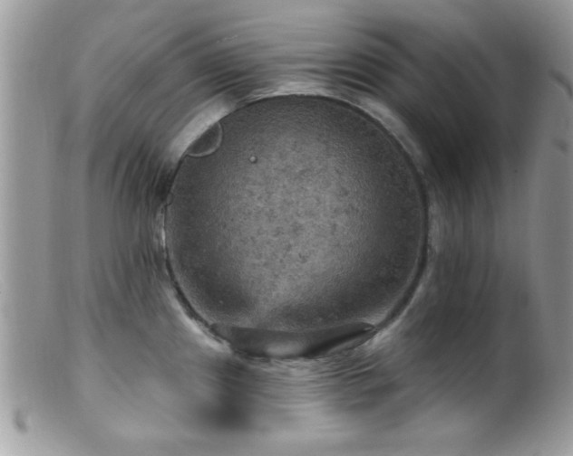 X0000099381241200805151611