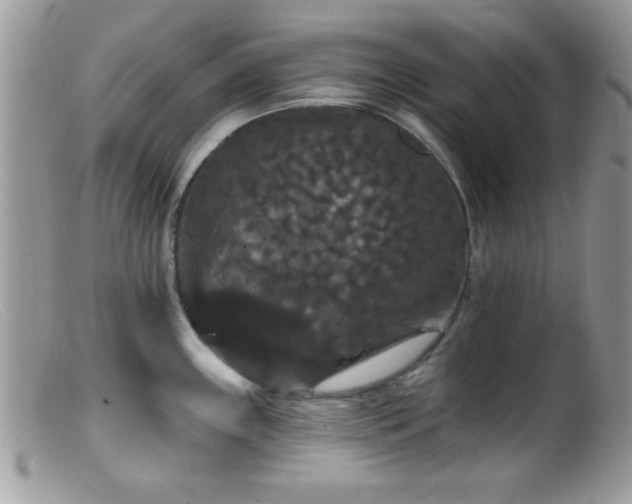 X0000099381243200805151611