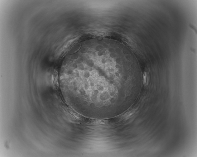 X0000099381251200805151610