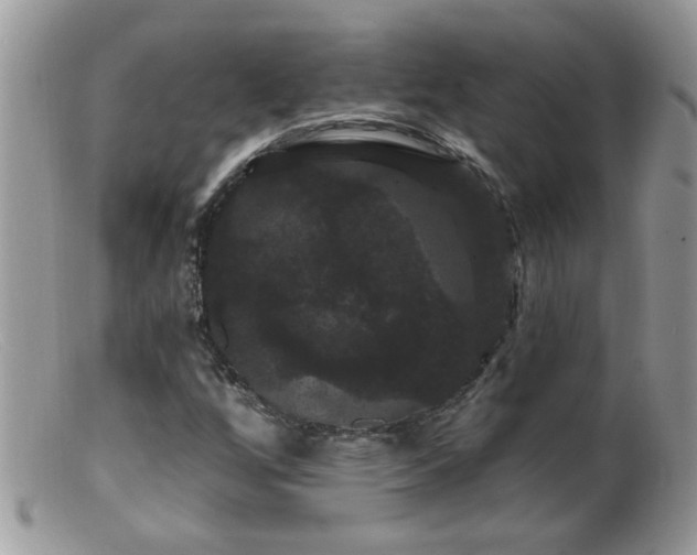 X0000099381256200805151610