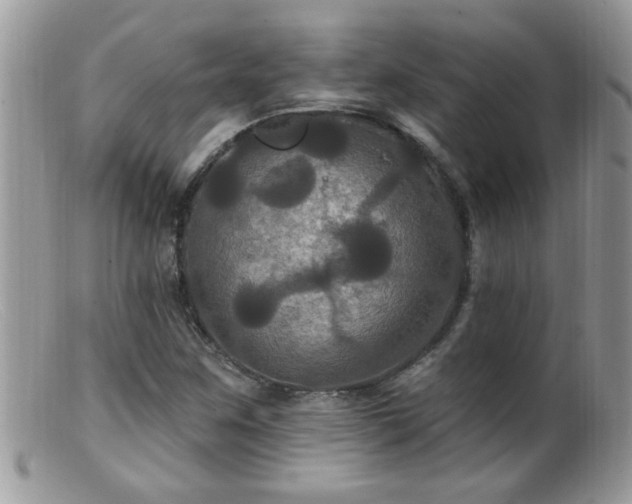 X0000099381259200805151610