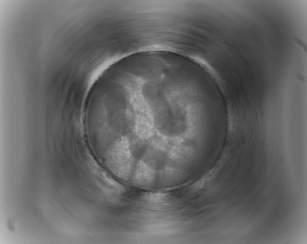 X0000099381278200805151609