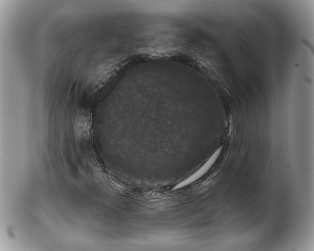 X0000099381300200805151609