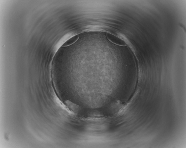 X0000099381386200805151608