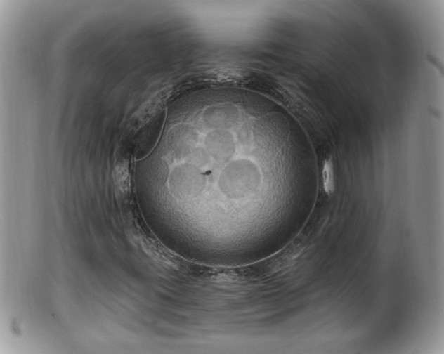 X0000099381395200805151607