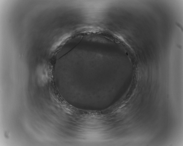 X0000099381399200805151607