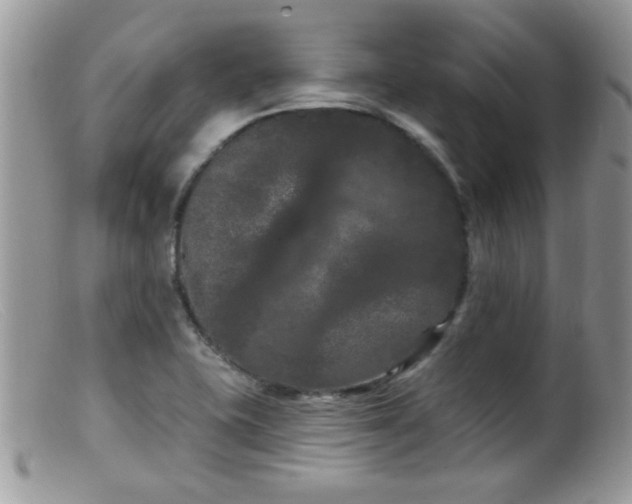 X0000099381415200805151607