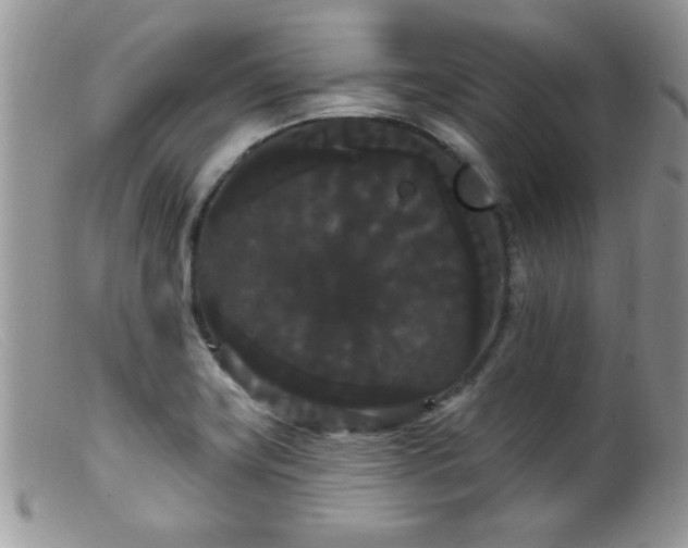 X0000099381419200805151607