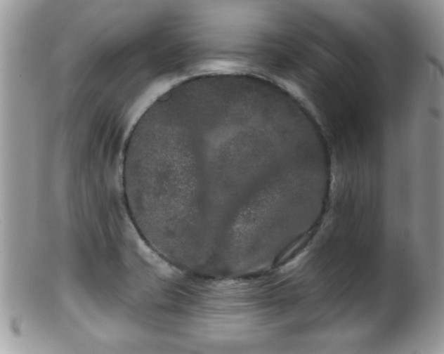 X0000099381421200805151608