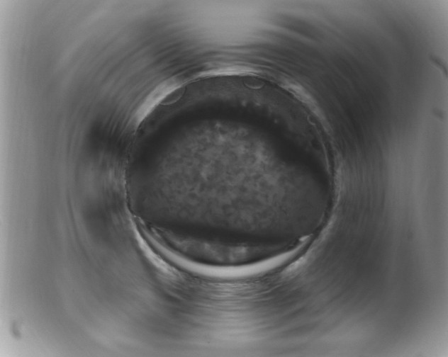 X0000099381425200805151608