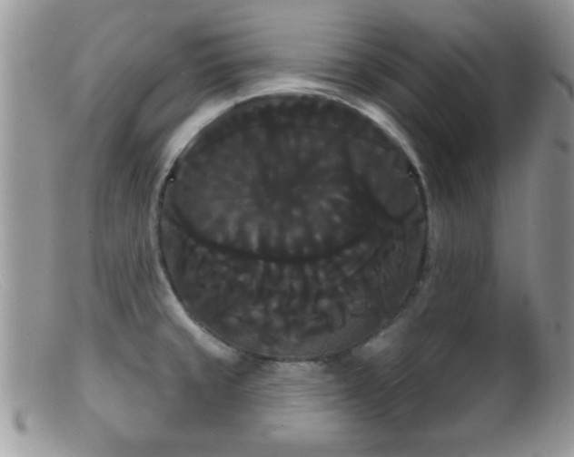 X0000099381429200805151608