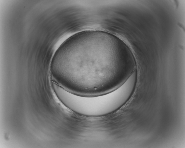 X0000099381440200805151608