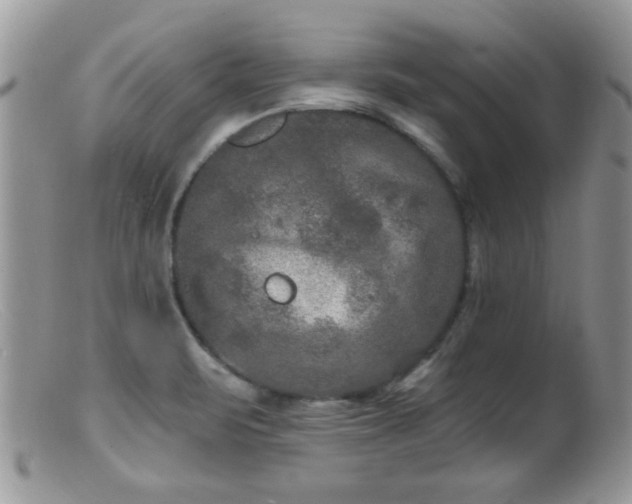 X0000099381471200805151606