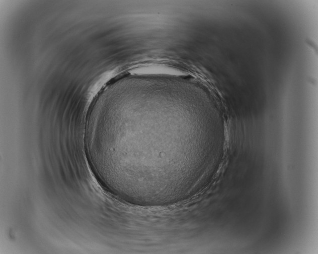 X0000099380003200805221817