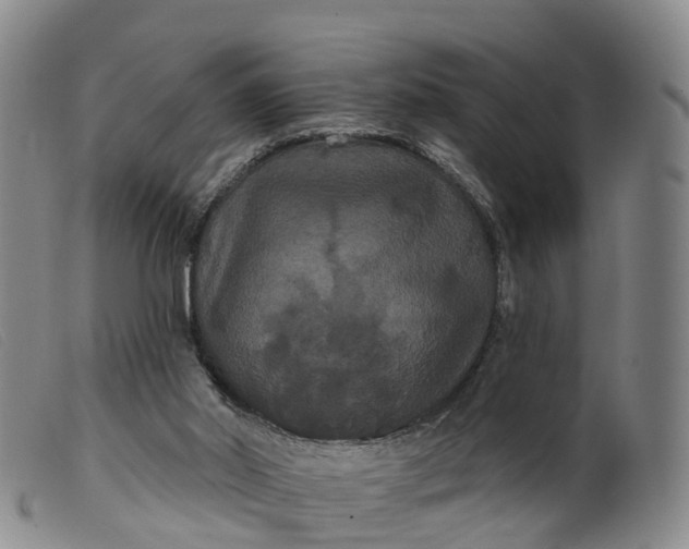 X0000099380014200805221817