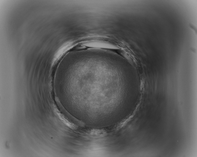 X0000099380101200805221816