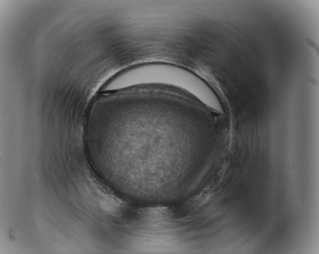 X0000099380108200805221815