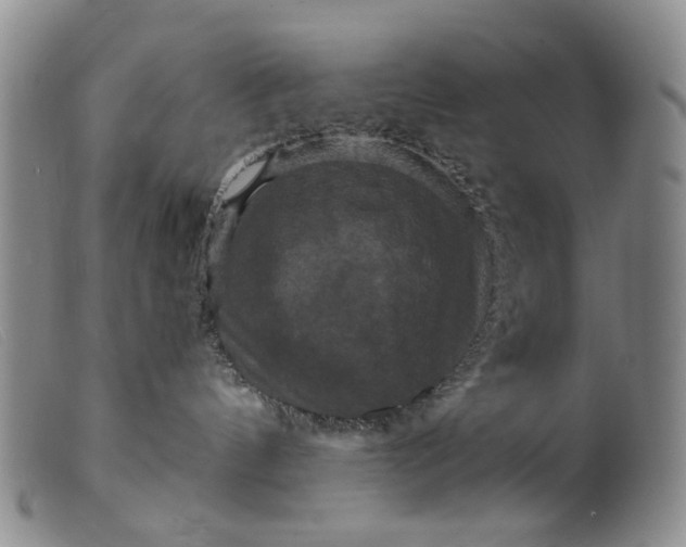 X0000099380144200805221815