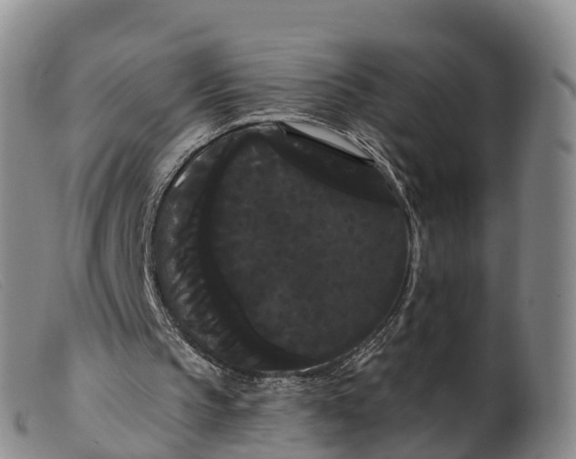 X0000099380145200805221814