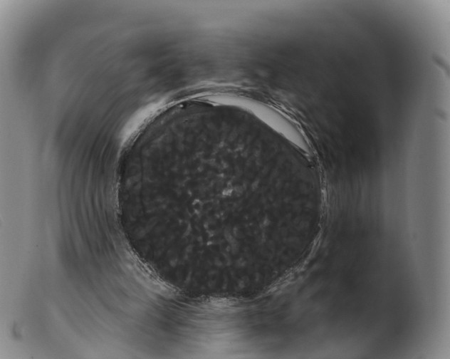 X0000099380149200805221814