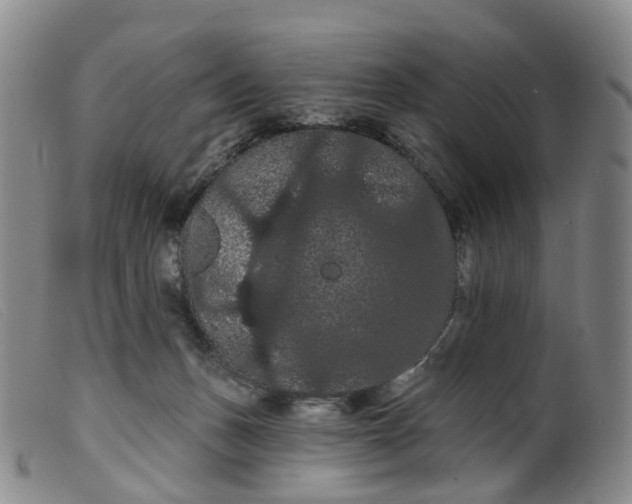 X0000099380175200805221815