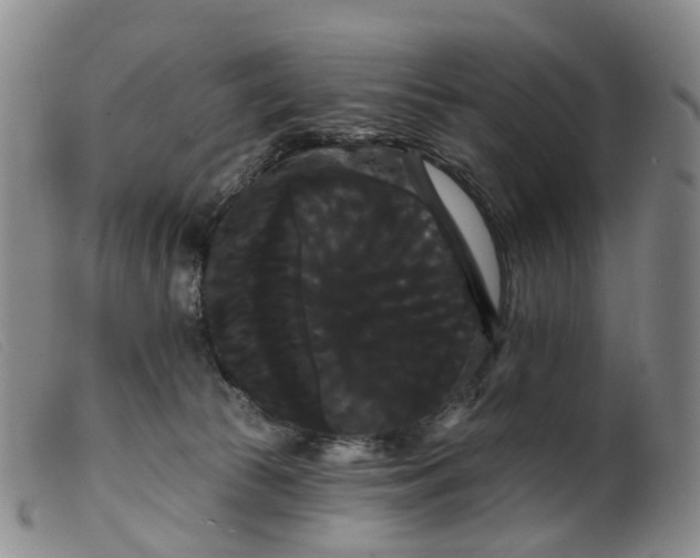 X0000099380177200805221815