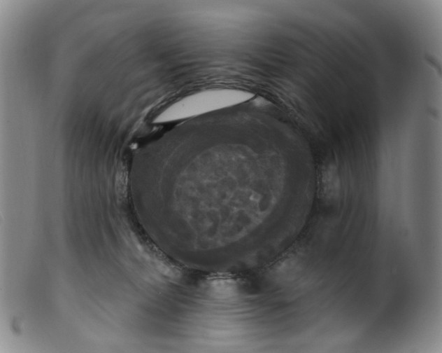 X0000099380228200805221814