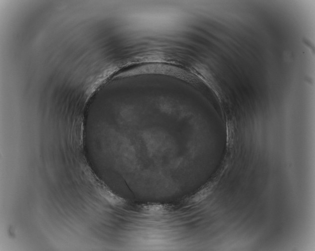 X0000099380301200805221812