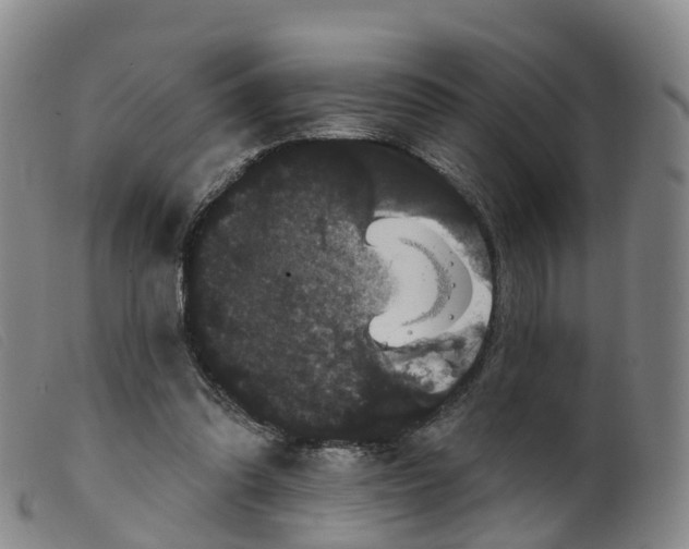 X0000099380302200805221812