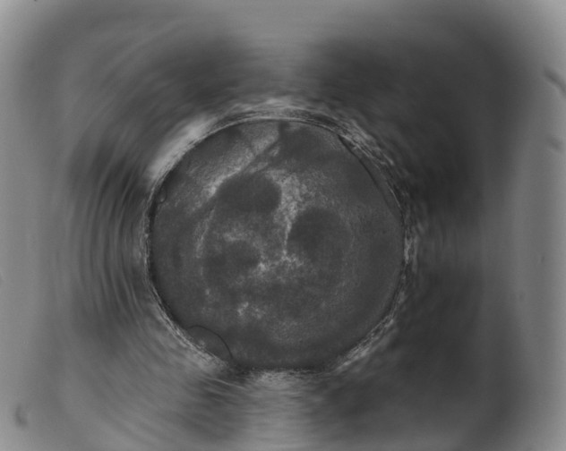 X0000099380341200805221811