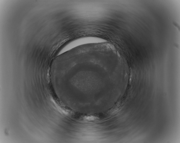 X0000099380360200805221812