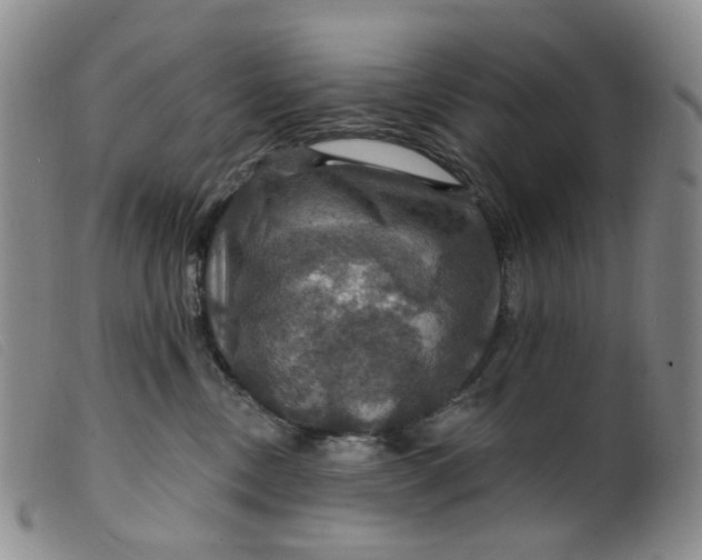 X0000099380378200805221812