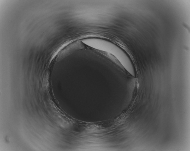 X0000099380387200805221811