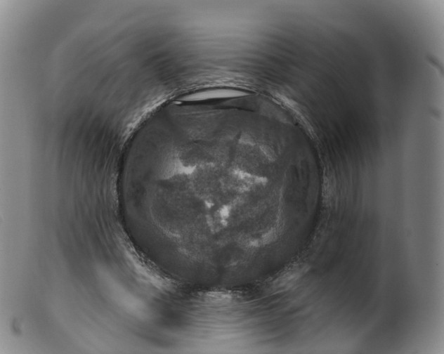 X0000099380394200805221811