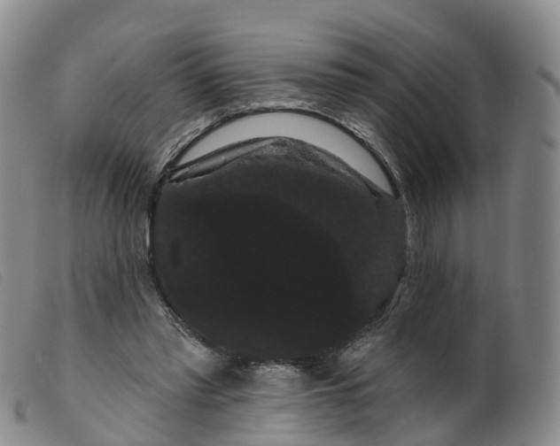 X0000099380397200805221811