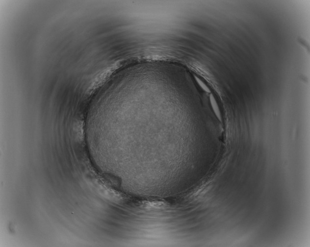 X0000099380401200805221811