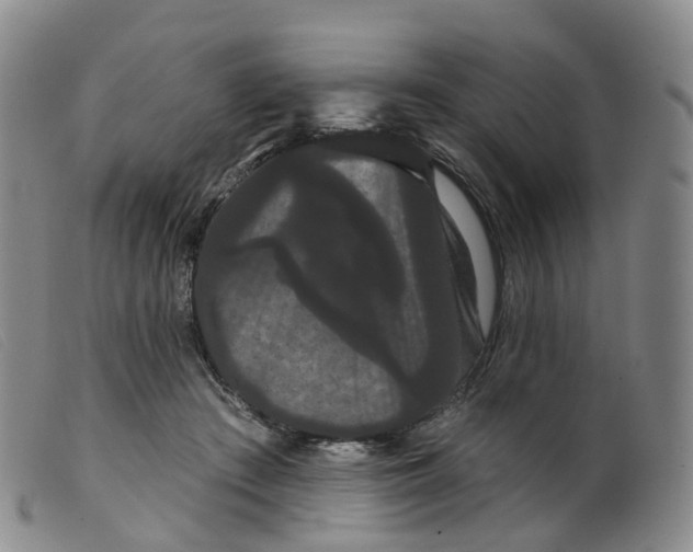 X0000099380409200805221811