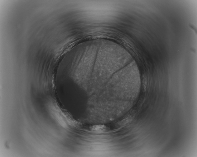 X0000099380410200805221811