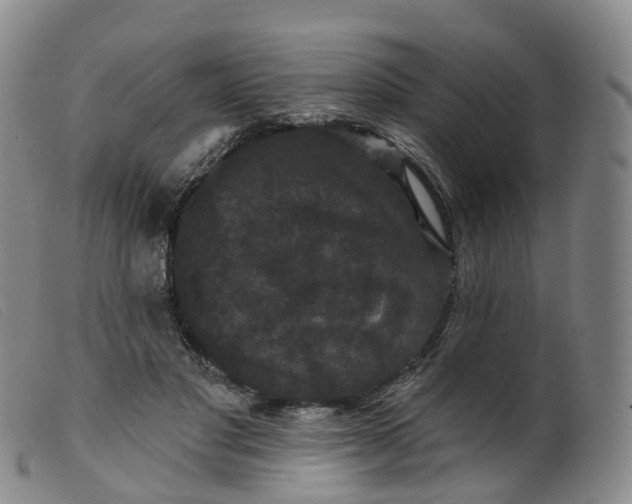 X0000099380501200805221810