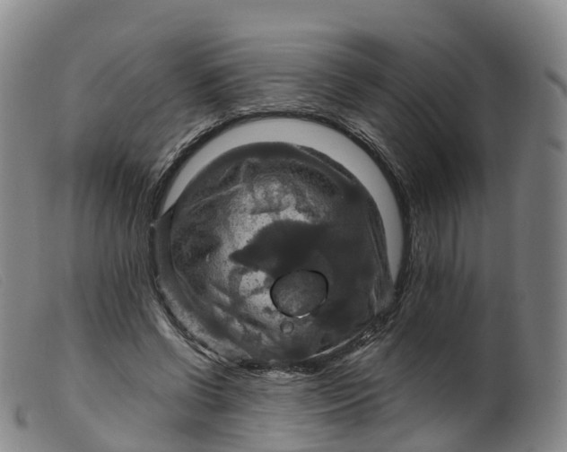 X0000099380542200805221809