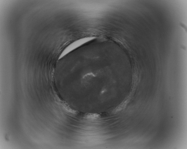 X0000099380576200805221809