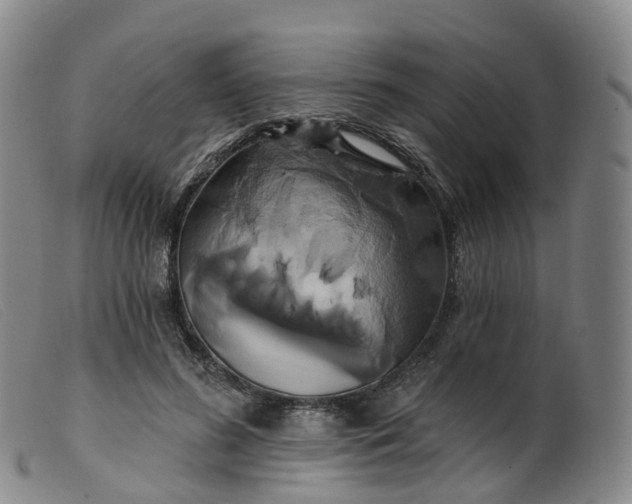 X0000099380596200805221808