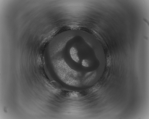 X0000099380618200805221808