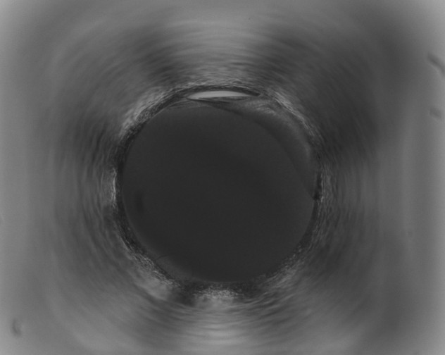 X0000099380685200805221807