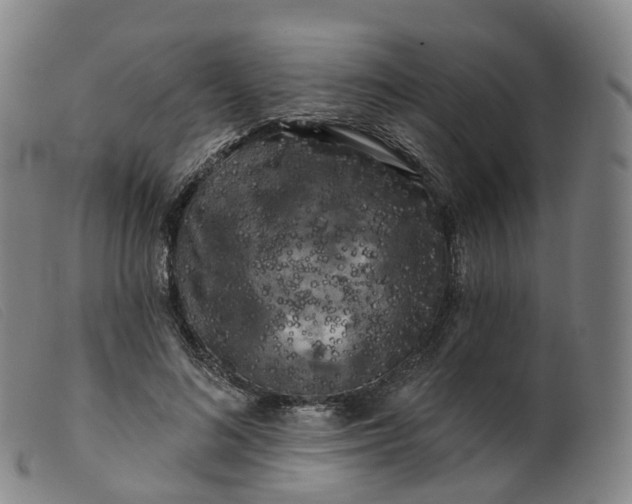 X0000099380692200805221807