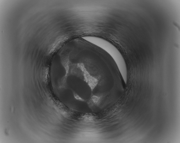 X0000099380742200805221806