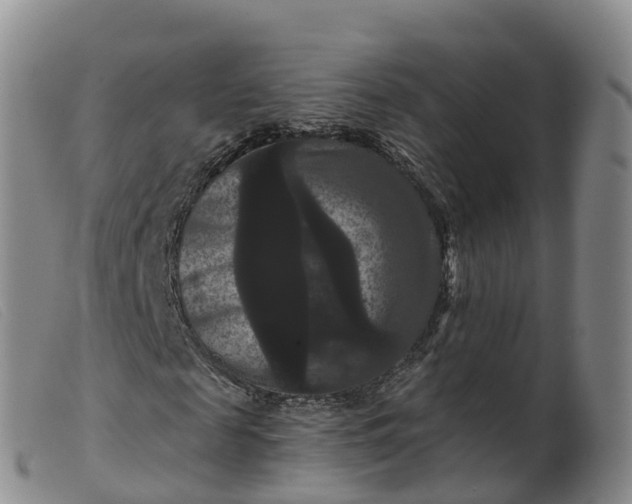 X0000099380817200805221803